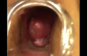 Wife speculum in pussy with jizz pregnant Cervix 2